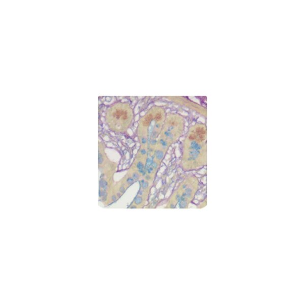 Colloidal Iron Stain Kit